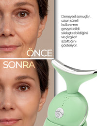 Yüz Güzellik Cihazı